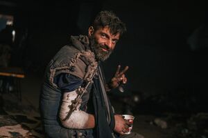 Військовослужбовцю треба оперувати руку, але він настільки схуд, що спочатку має набрати вагу, каже його сестра