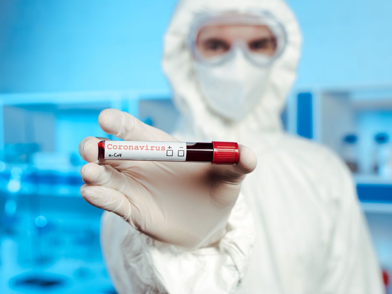 Данные о COVID-19 будут публиковать не каждый день, а за неделю