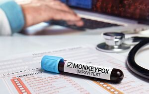 В Україні немає випадків цього захворювання, як і підозр на нього