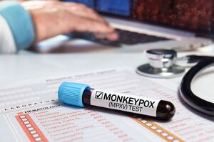 В Україні немає випадків цього захворювання, як і підозр на нього