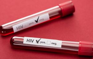 Україна посідає одне з перших місць серед країн європейського регіону за кількістю ВІЛ-позитивних осіб