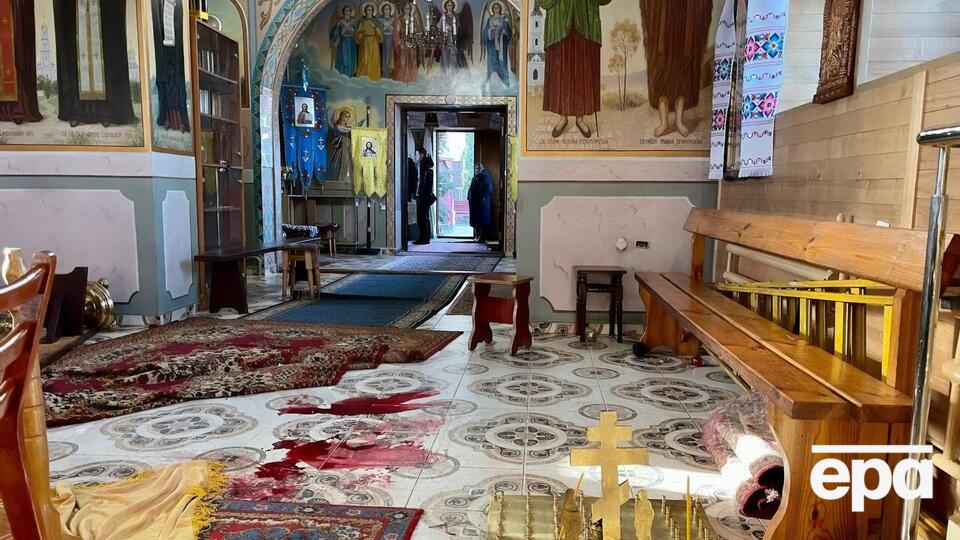 Постраждалий перебуває в реанімації