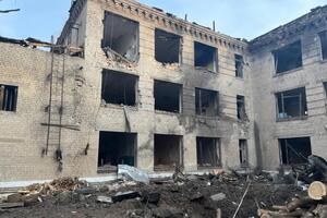 Точна кількість жертв російської агресії в Україні поки невідома