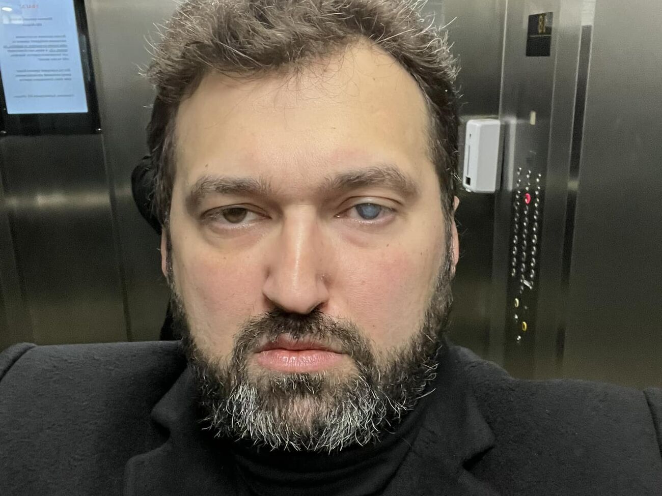Залужний підтримав Резнікова, і це дасть змогу отримати більше допомоги від Заходу. Така єдність військових – яскравий контраст на тлі гризні в росіян