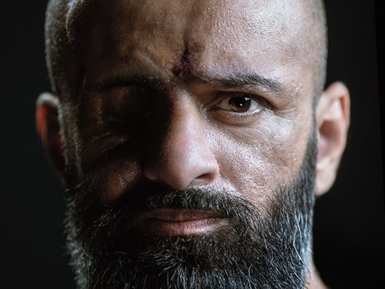 Голова НБУ Пишний кілька років тому втратив слух. Але він демонструє, що поранення – це нове життя, у якому ти сильніший, ніж був