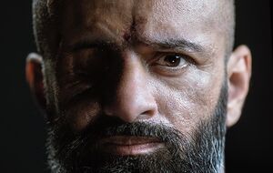 Голова НБУ Пишний кілька років тому втратив слух. Але він демонструє, що поранення – це нове життя, у якому ти сильніший, ніж був