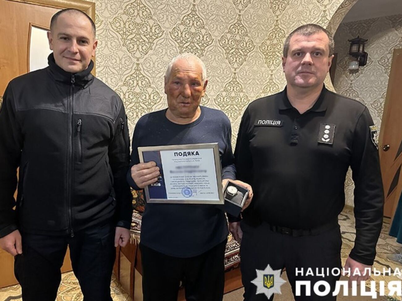 Житель Киева получил ожоги, однако спас другие автомобили от пожара, отметили в полиции