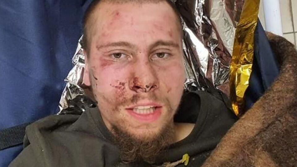 ЗСУ взяли бойовика в полон у Донецькій області