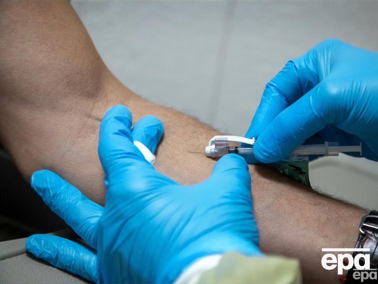 Випадки віспи мавп уже зафіксували в Україні