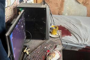 Взрывом человеку разнесло левую руку