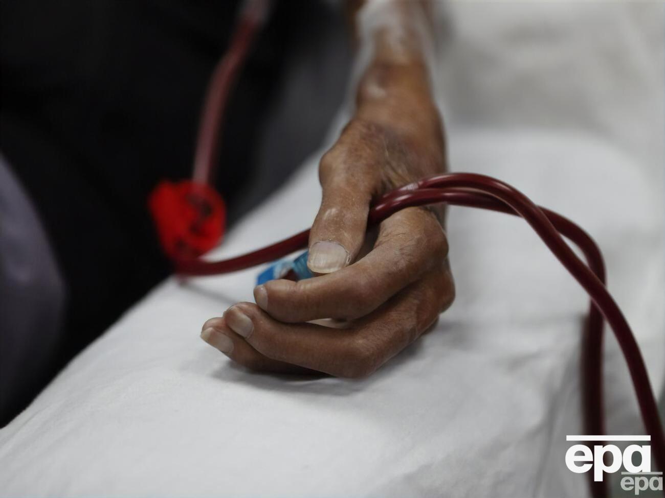 Хворобу вивчають медики