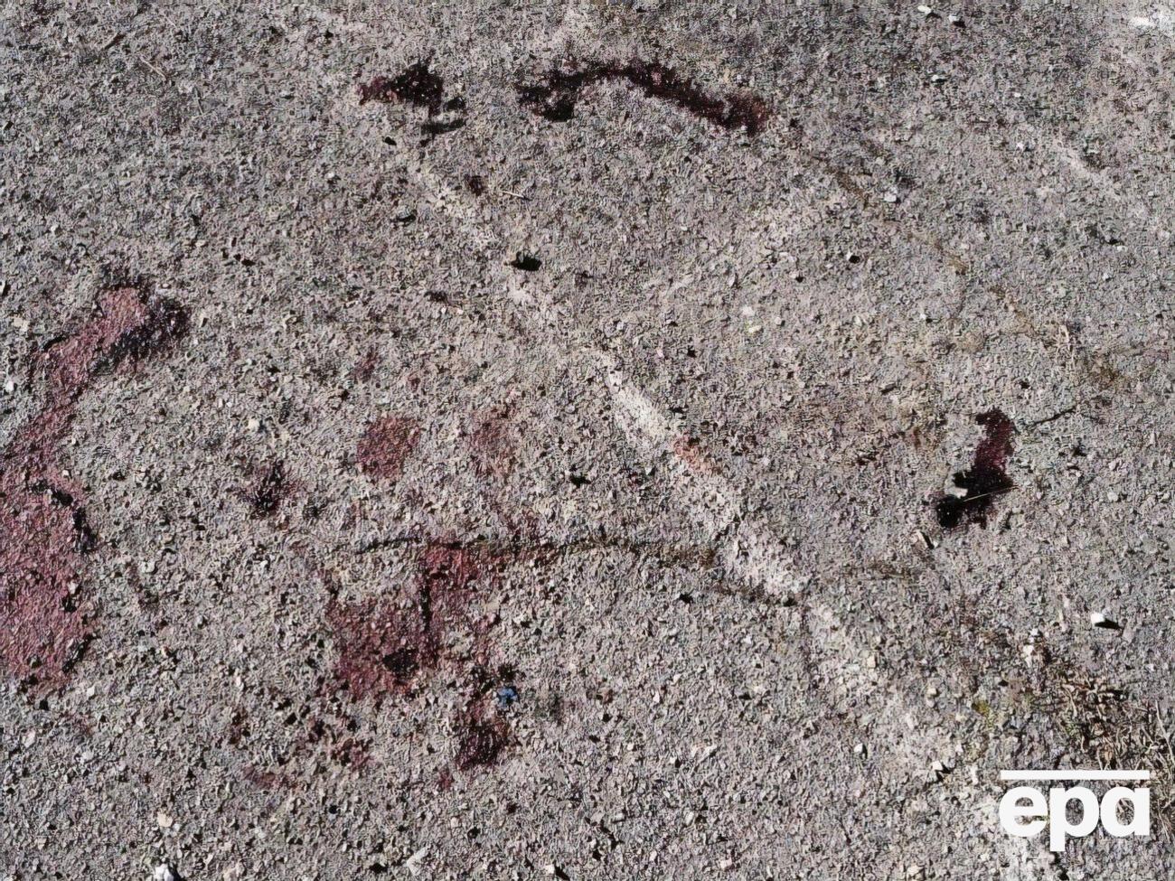 Дев'ятьом постраждалим унаслідок обстрілу РФ надають кваліфіковану медичну допомогу, зазначили в ОГПУ