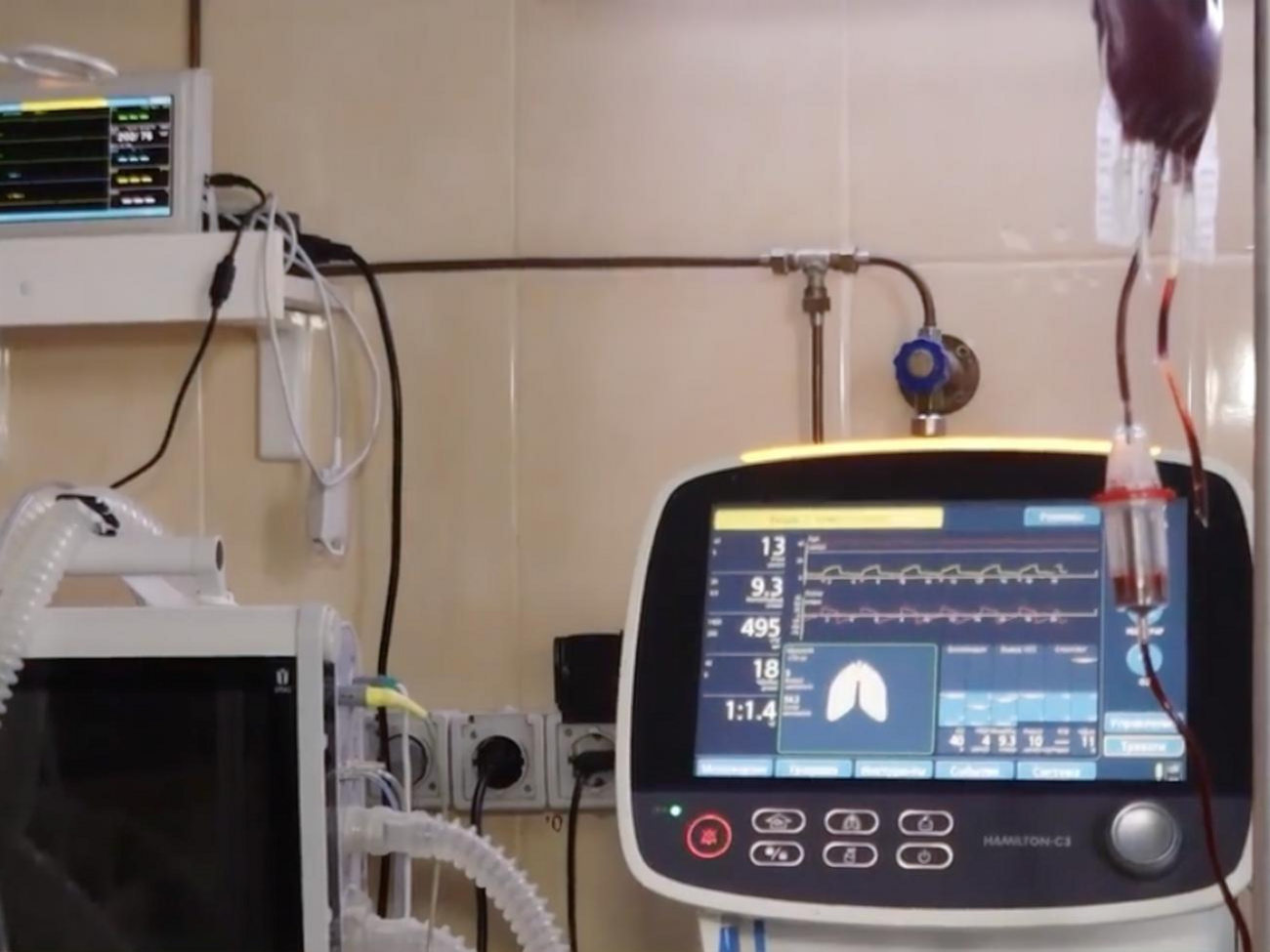 Мониторы пациента показывают сатурацию, работу сердца, делают ЭКГ, меряют давление