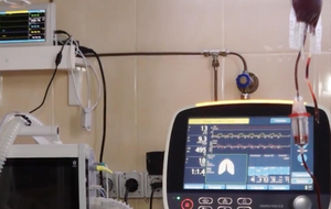 Мониторы пациента показывают сатурацию, работу сердца, делают ЭКГ, меряют давление