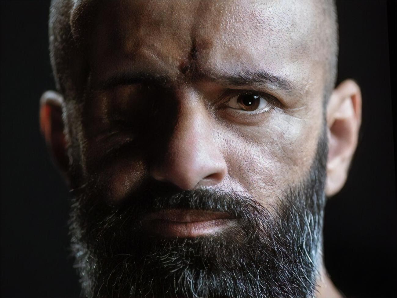 Большинство раненых не имеют справедливых выплат во время лечения. Нужно изменить эти правила