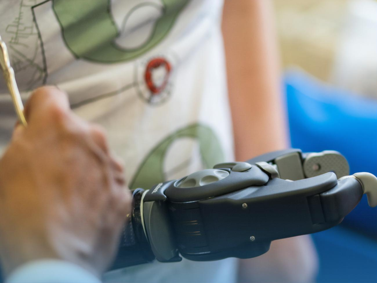 Серед основних напрямів роботи "Рятуємо життя" – протезування й реабілітація військових і мирних жителів