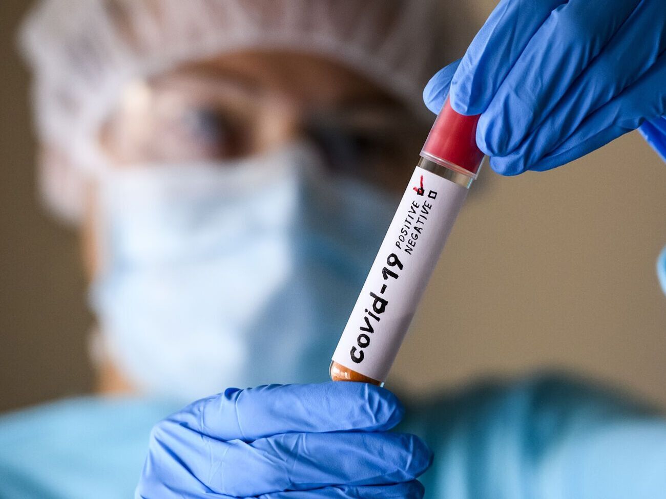 Еженедельно из-за коронавируса в Украине умирает около 100 человек, сообщил главный санитарный врач