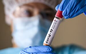 Щотижня через коронавірус в Україні помирає приблизно 100 людей, повідомив головний санітарний лікар