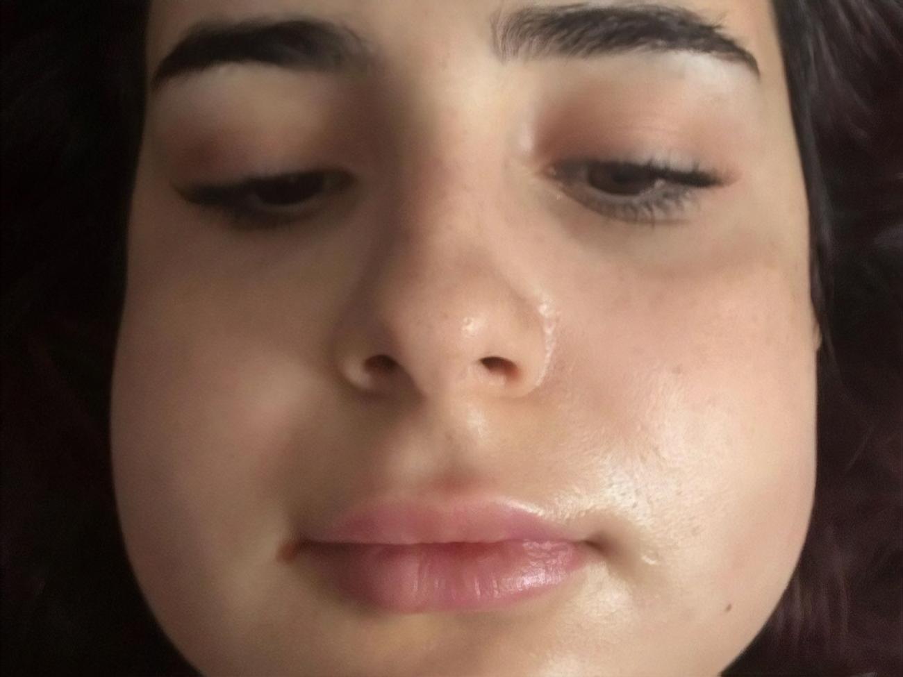 Трінчер: Мд-а-а-а, чесно, я думала, що після мамопластики вирвати зуби для мене буде як очима кліпнути