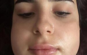 Тринчер: М-да-а-а, честно, я думала, что после маммопластики вырвать зубы для меня будет как глазами моргнуть