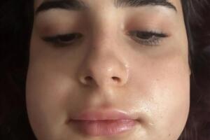 Трінчер: Мд-а-а-а, чесно, я думала, що після мамопластики вирвати зуби для мене буде як очима кліпнути