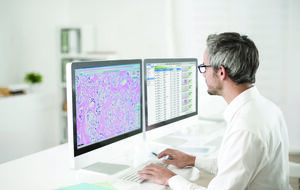 Использование специального цифрового сканера призвано кардинально улучшить ситуацию с диагностикой и лечением онкологических заболеваний