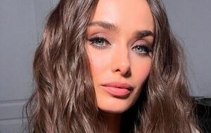 Мішина заявила, що не має наміру робити пластичну операцію