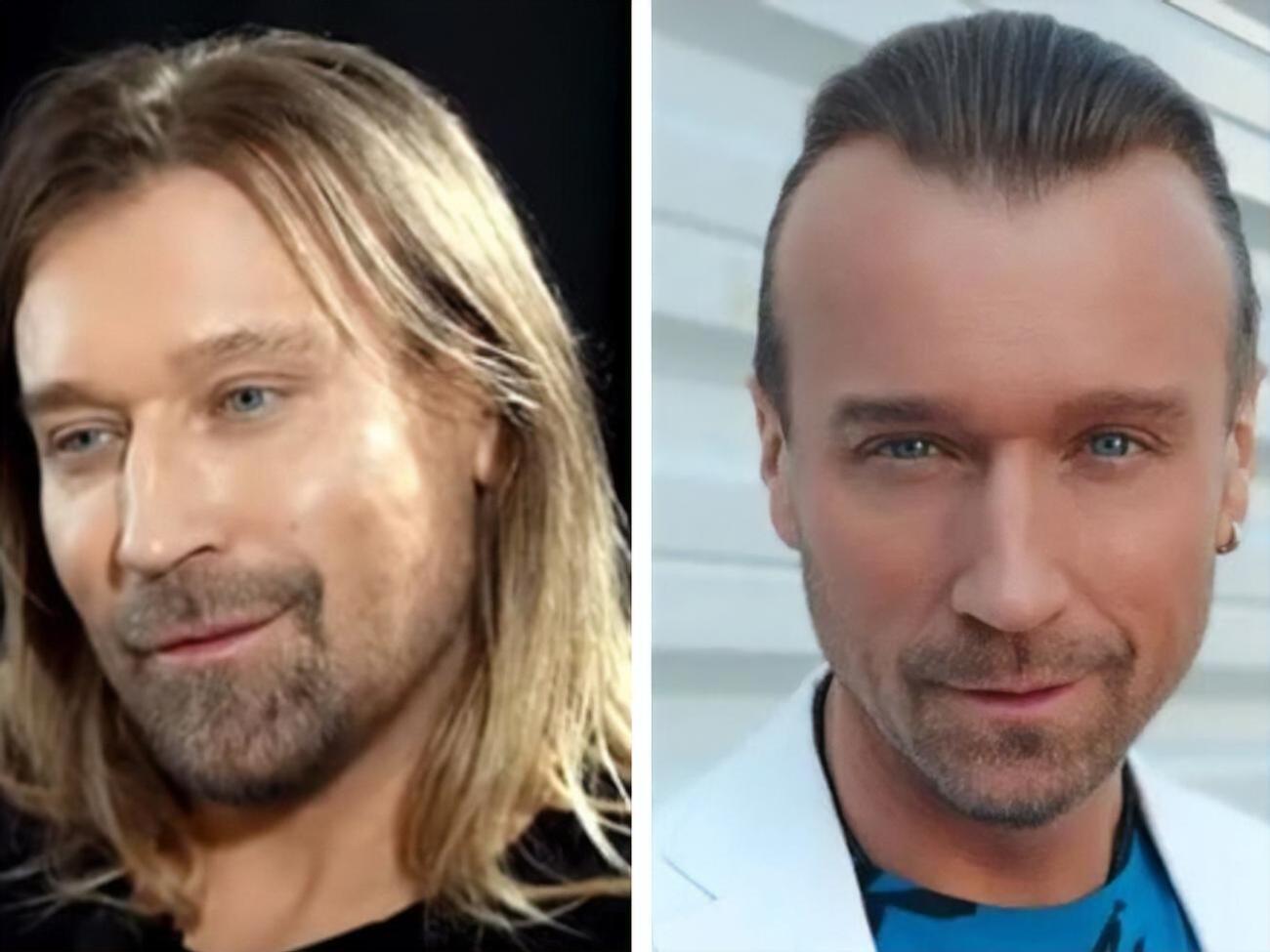 За словами Винника, у Берліні, де він живе, дуже складно з перукарями