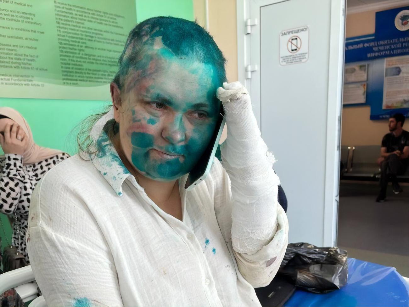 Журналистку избили, обрили наголо и облили зеленкой