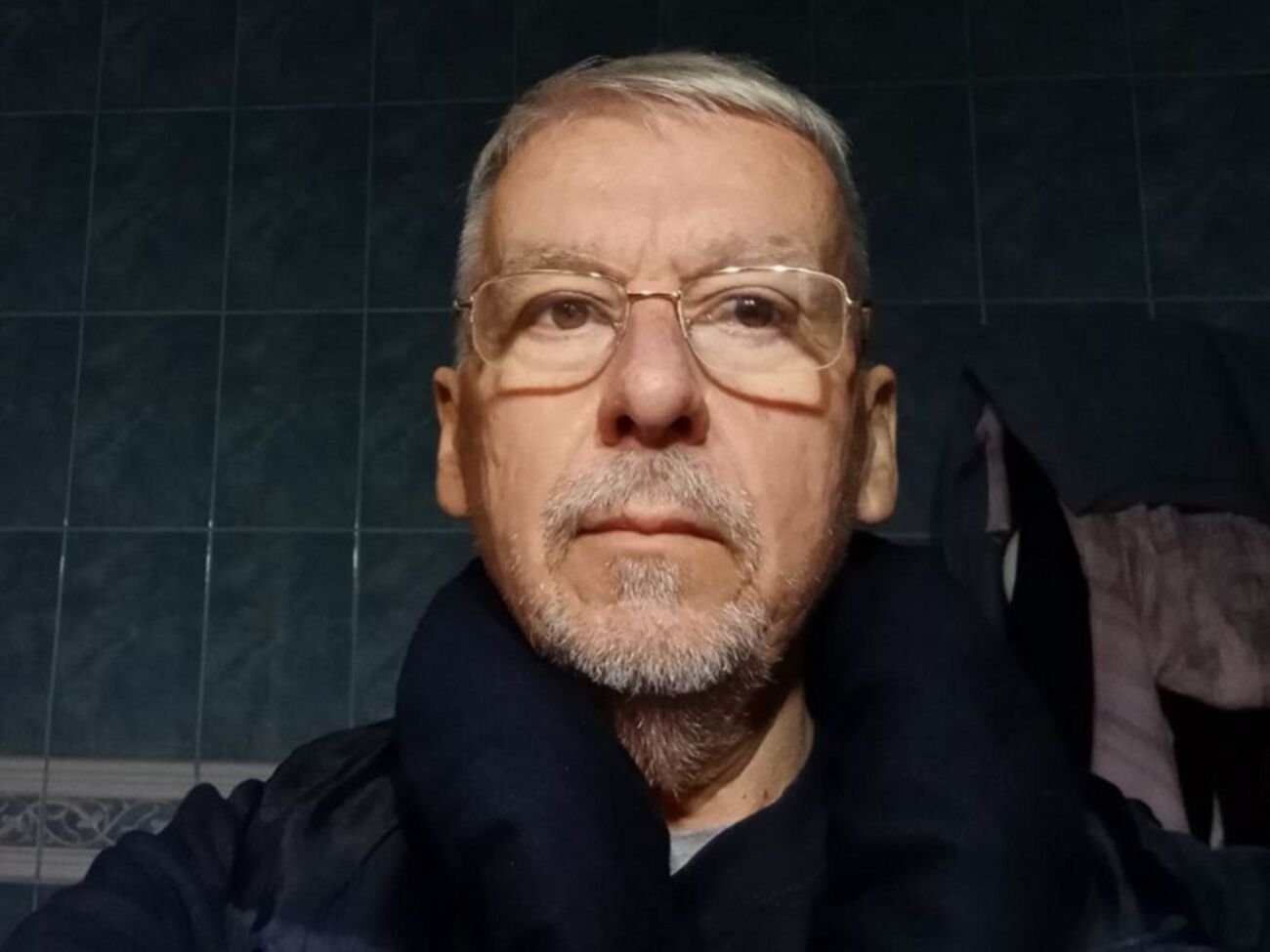 Клочко:&nbsp;Перед операцией меня развлекает персонал, спрашивают: "Какого года выпуска ваша машина?"