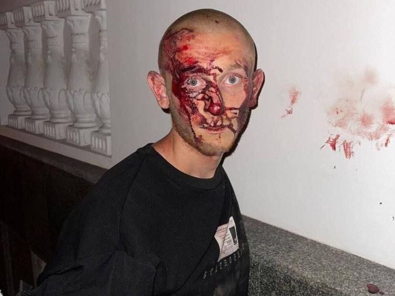 Судя по фото, полтавчанин сопротивлялся и получил травмы