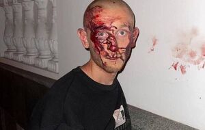 Судя по фото, полтавчанин сопротивлялся и получил травмы