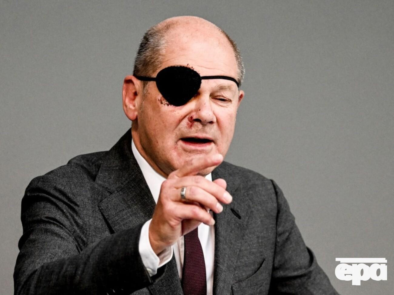 Шольц дістав травму на початку вересня під час пробіжки