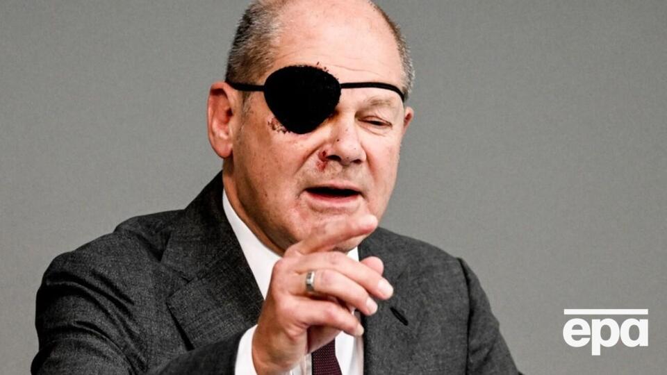 Шольц получил травму в начале сентября во время пробежки