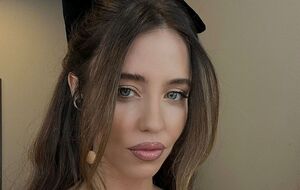 Ранее Дорофеева была участницей группы "Время и Стекло"