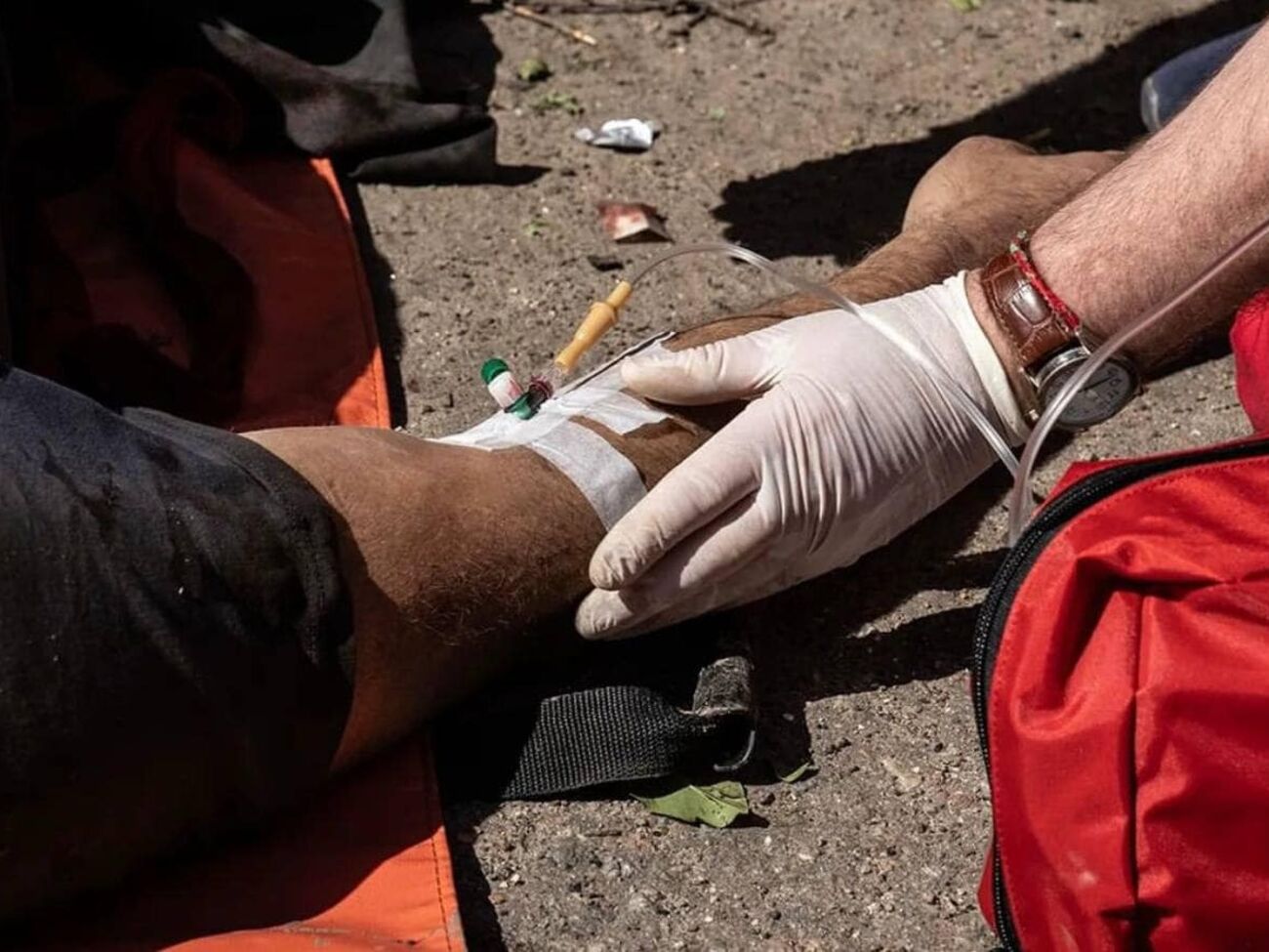 Один из раненых позже умер в больнице