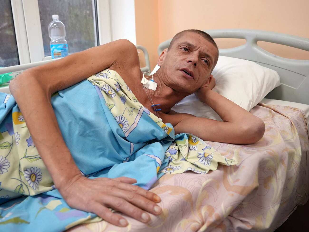 Військовий дістав поранення, наступивши на міну