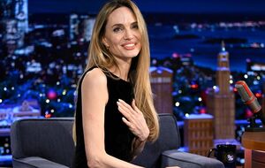 Напередодні шоу Джолі травмувала палець