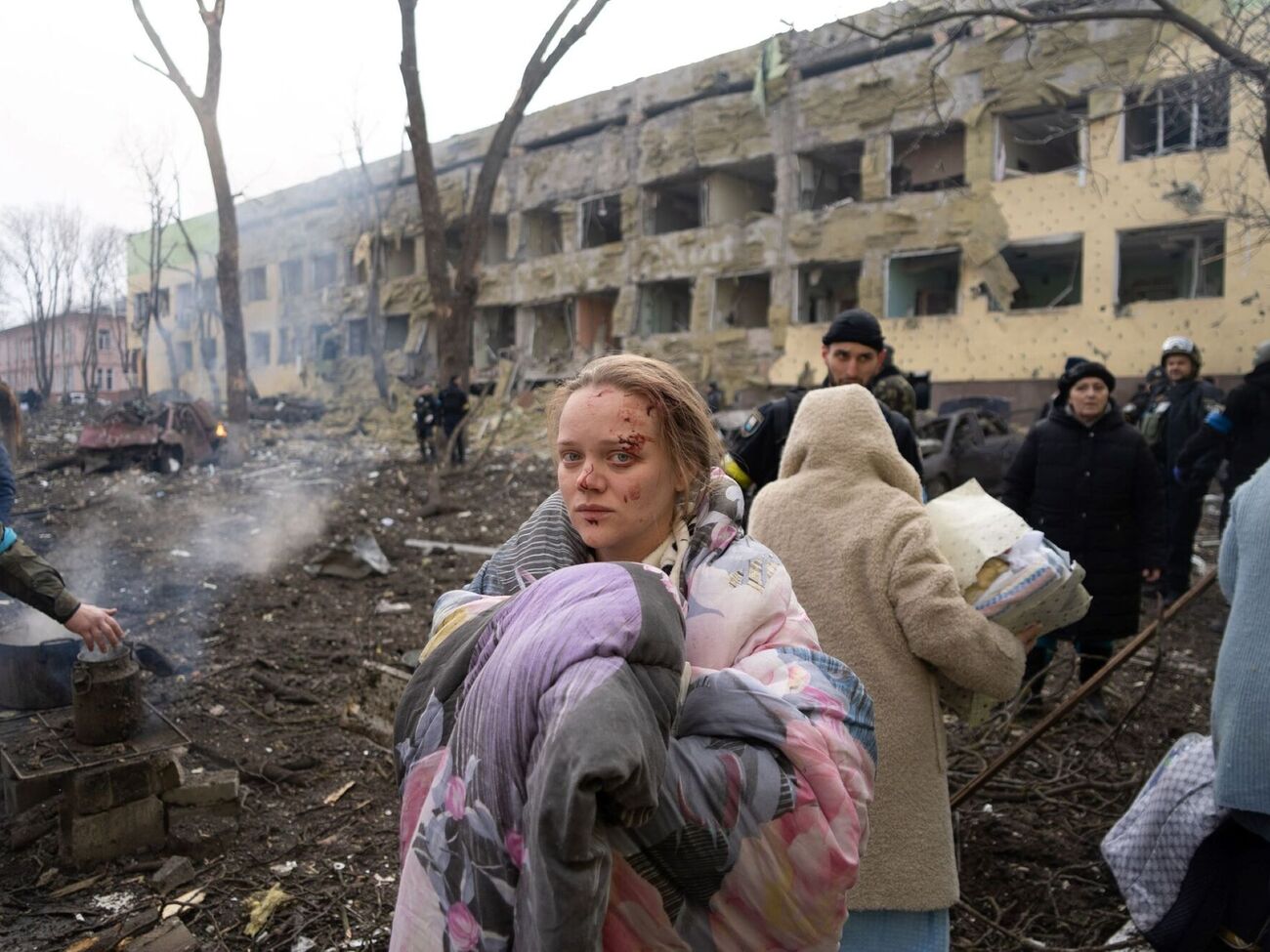Фото Вишемирської, яка вижила після авіаудару російських окупантів по маріупольському пологовому будинку, облетіло весь світ