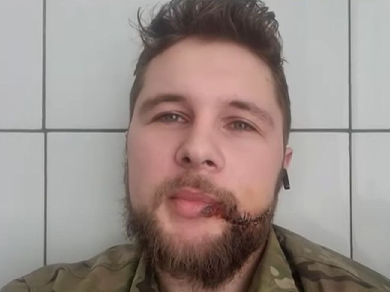 Біляк: Мала приїхати БМП і забрати поранених, ми всі останнього на це надіялися