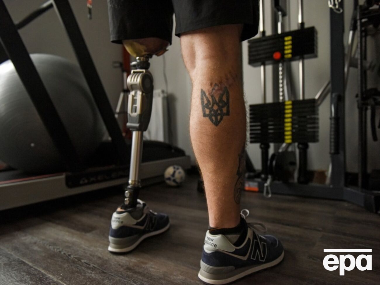 Поранених із кінцівками – понад 74% від загальної кількості, зазначив представник фонду