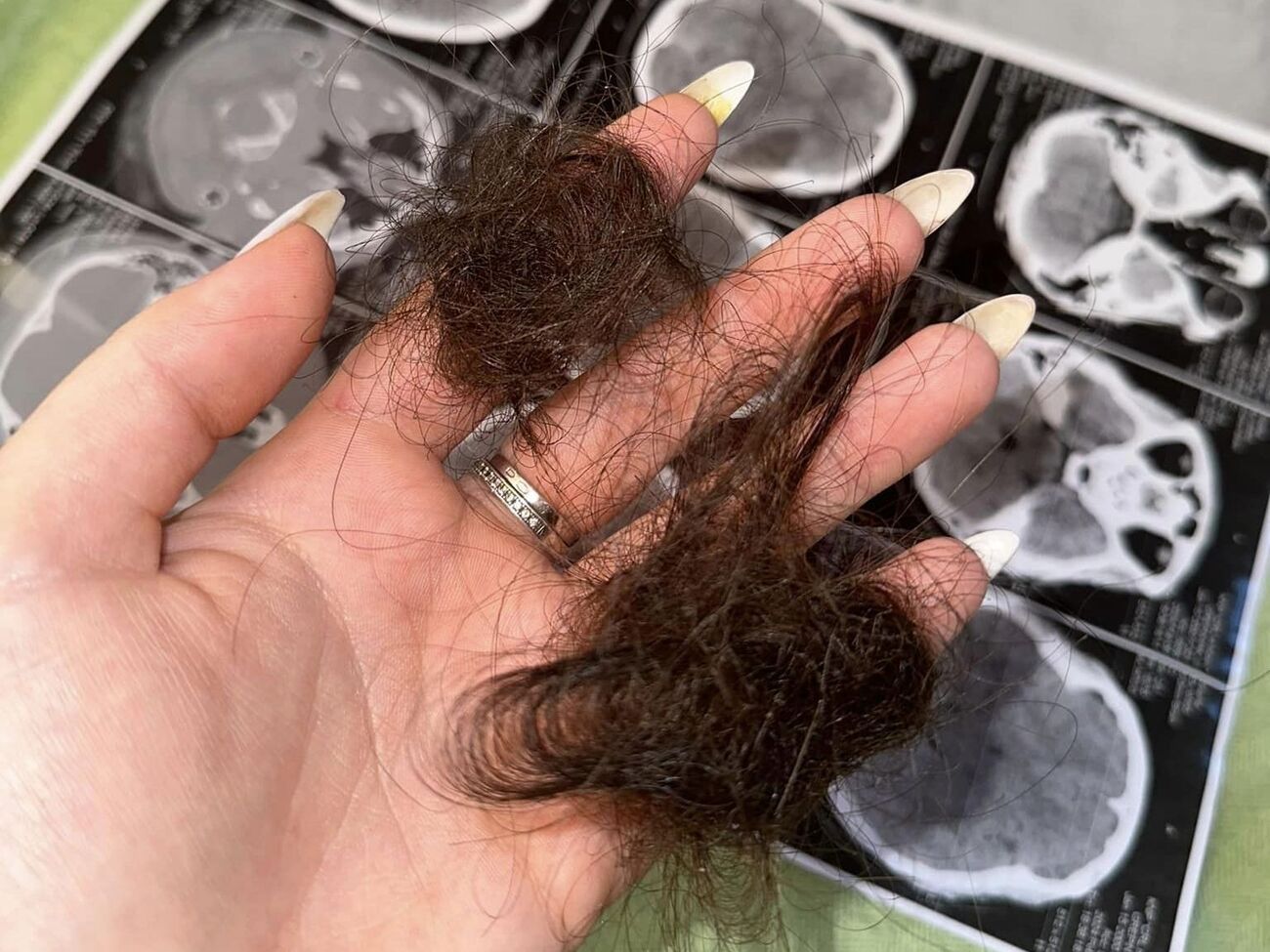 Потерпевшая рассказала, как ее избивали и рвали ей волосы