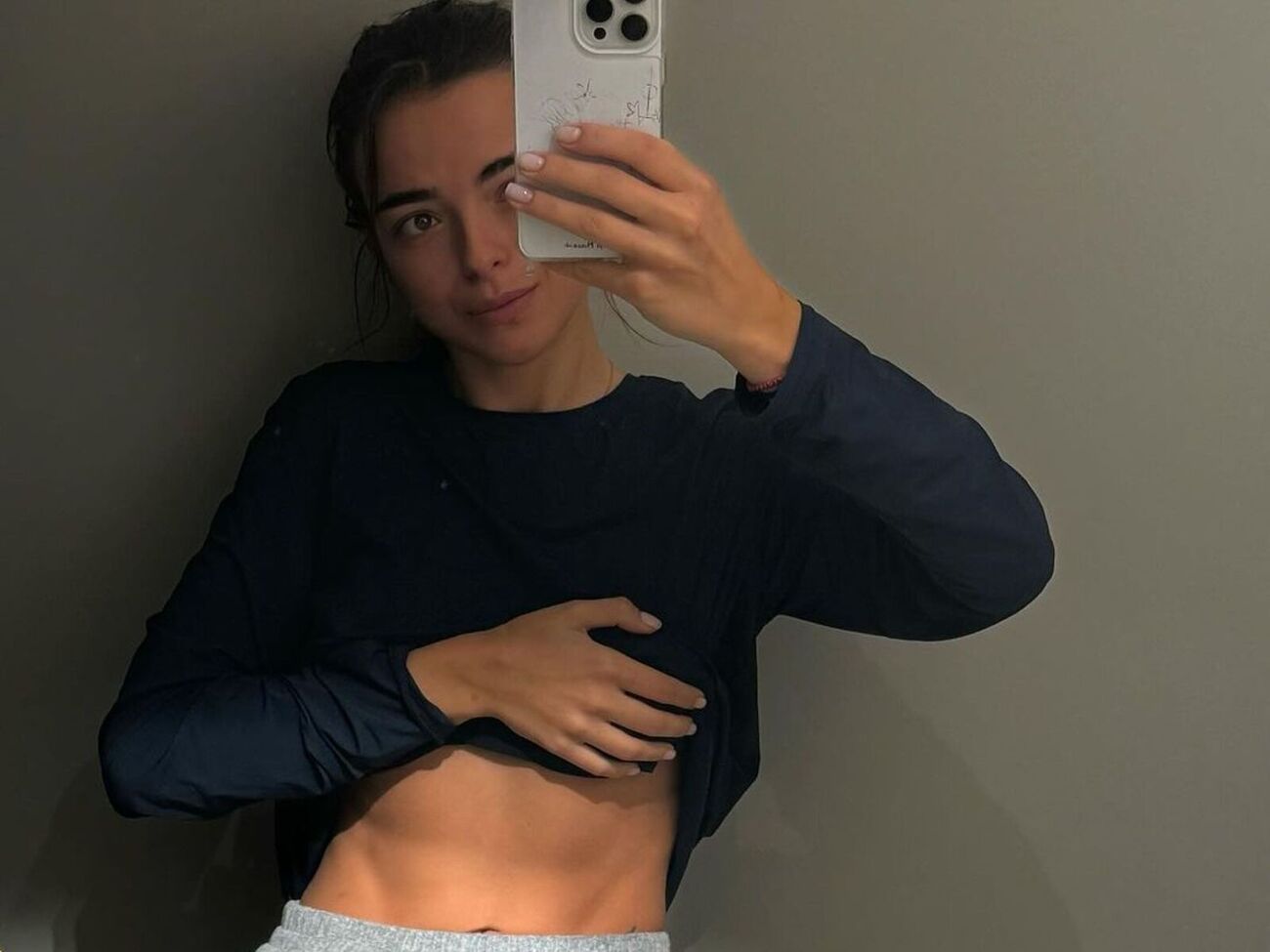 Морозюк: Расстройство пищевого поведения – это психическая, психологическая проблема, когда у тебя нет здоровых отношений с едой