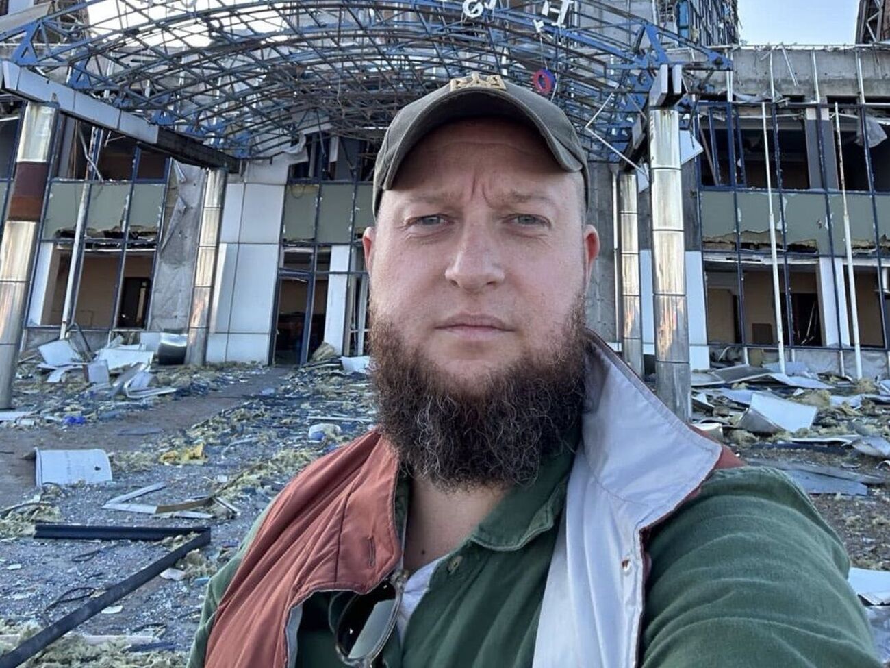 Рука ветерана Дениса після 16 операцій так і не почала працювати. Він ампутував її і поставить протез. Не уявляю, як це – ухвалювати такі рішення