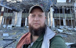 Рука ветерана Дениса після 16 операцій так і не почала працювати. Він ампутував її і поставить протез. Не уявляю, як це – ухвалювати такі рішення