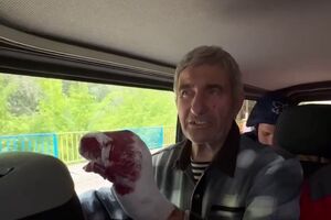 Медики надали допомогу постраждалому чоловікові, розповіли у прокуратурі