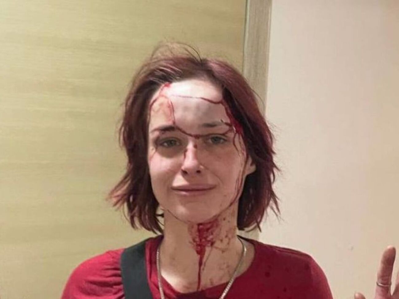 Одесситка пожаловалась на избиение возле отделения полиции