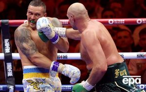 Команда Усика спростувала інформацію про те, що український чемпіон дістав перелом щелепи