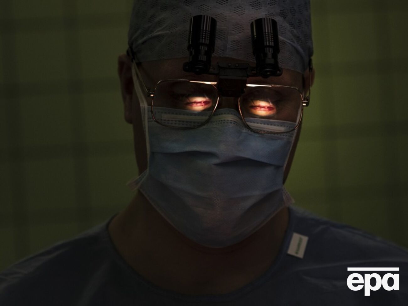 В Украине с 2019 года действует закон, разрешающий трансплантацию органов