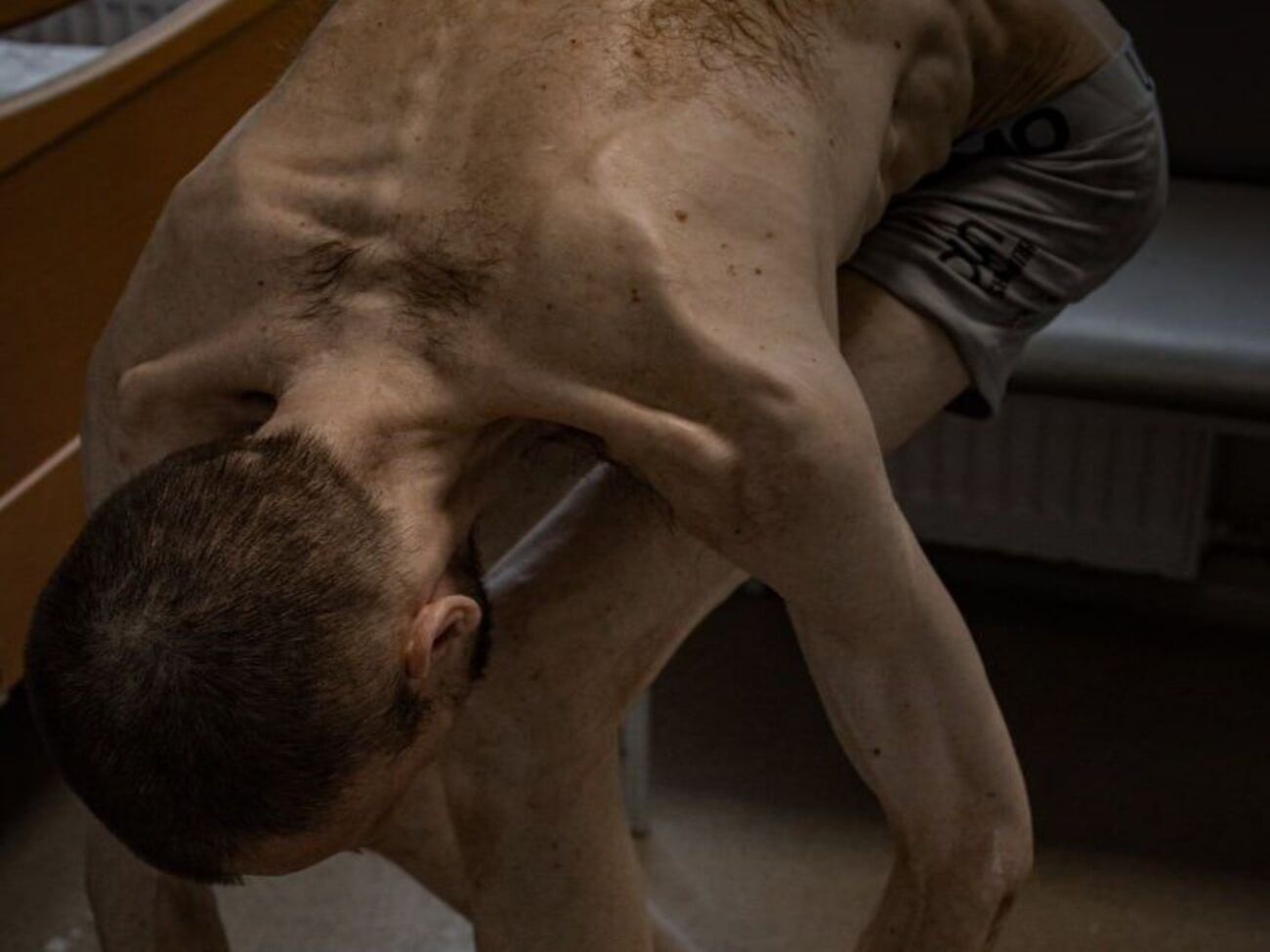 В проекте "Хочу жить" показали, как выглядит украинец после российского плена